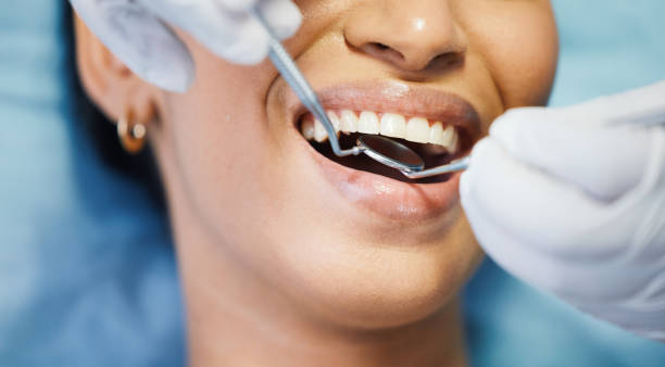 Best Emergency Cosmetic Dentistry (e.g., broken veneers) in Grandview, TX